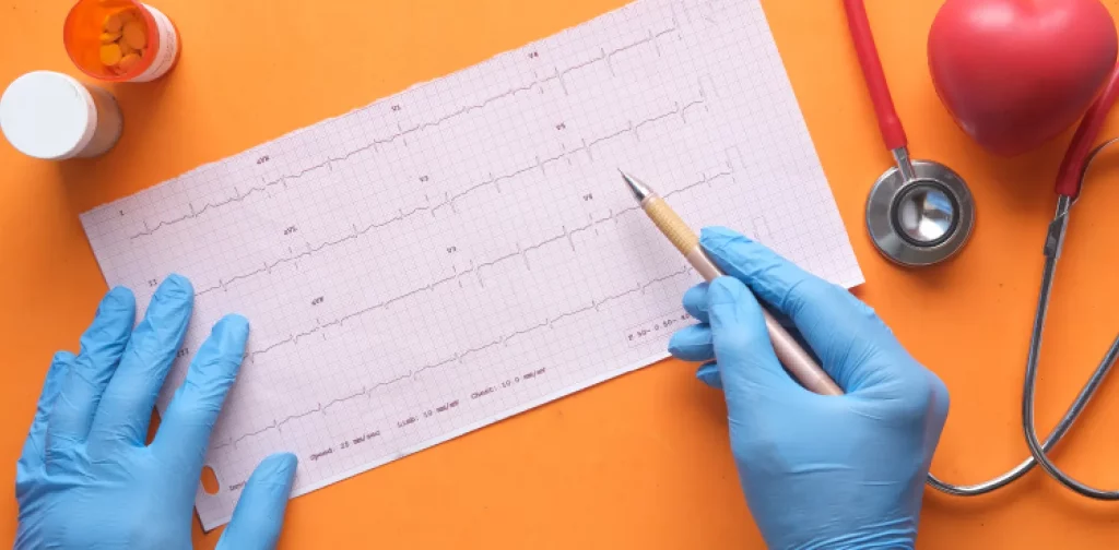 gloved hands holding a pencil above a paper showing heart rate
