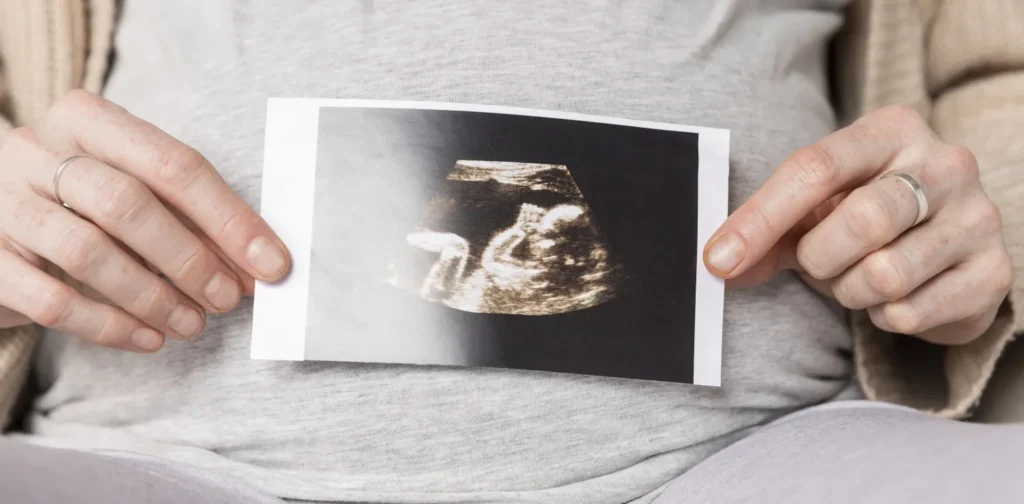 a woman holding a pregnancy ultrasound scan over her belly