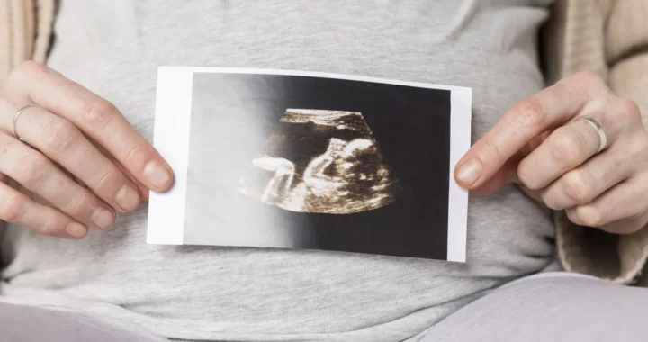 a woman holding a pregnancy ultrasound scan over her belly