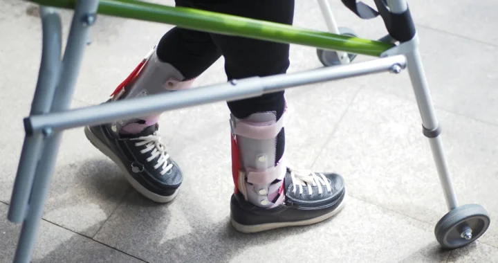a pair of legs wearing assistive shoes and a crutch